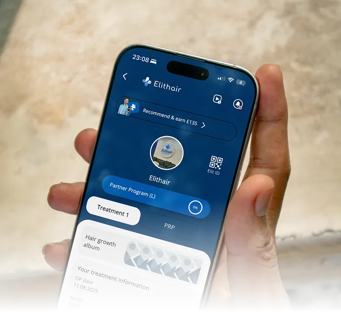 A person holding a smartphone displaying the Elithair patient app, showing treatment information, graft counts, and a hair growth photo album