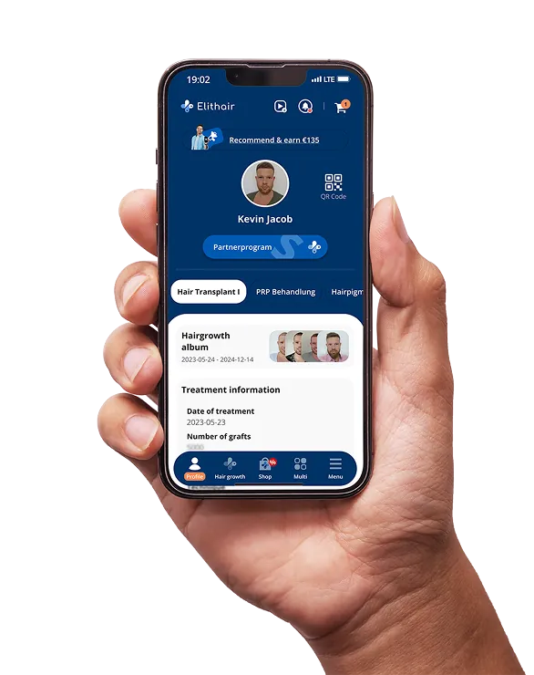 Smartphone showing Elithair app with patient hair growth album and graft info
