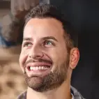 Thumbnail of a smiling man showcasing successful hair transplant results